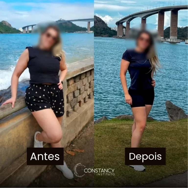 Antes.webp
